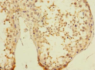 UBXD6 Antibody