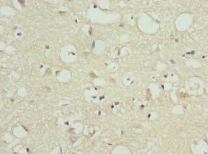 Polyclonal Rabbit anti-Human FAIM2 / LIFEGUARD Antibody (IHC)