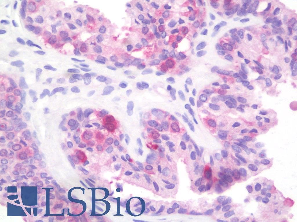 IHC-plus™ PTPRD / RPTP-Delta Antibody (aa343-371)