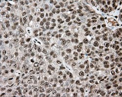 APP / Beta Amyloid Precursor Antibody (clone OTI5F1)