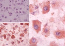 SIPR3 / EDG3 / S1P3 Antibody (aa300-350)