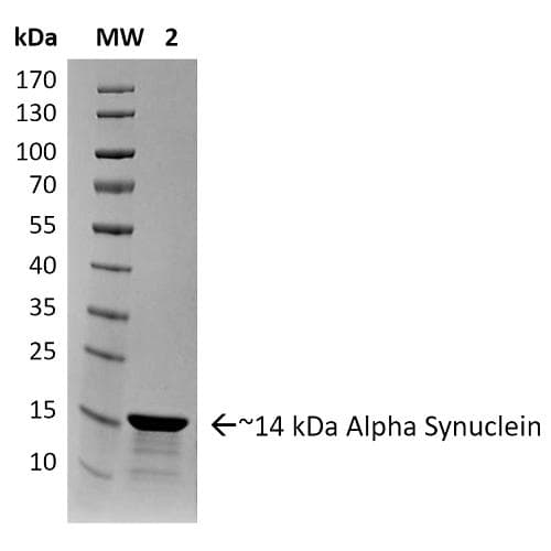 Human SNCA / Alpha-Synuclein Protein (Recombinant)