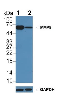 MMP9 / Gelatinase B Antibody (aa225-390)