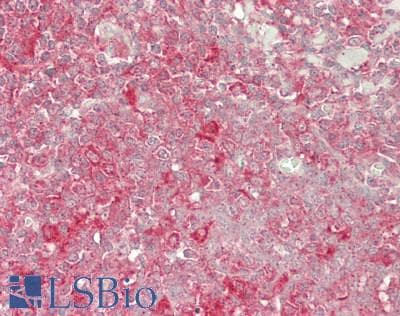 IHC-plus™ Polyclonal Rabbit anti-Human PRKAA1 / AMPK Alpha 1 Antibody (aa350-400, IHC, WB)