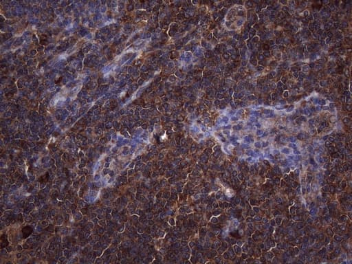 NARS2 Antibody (clone OTI5A9)