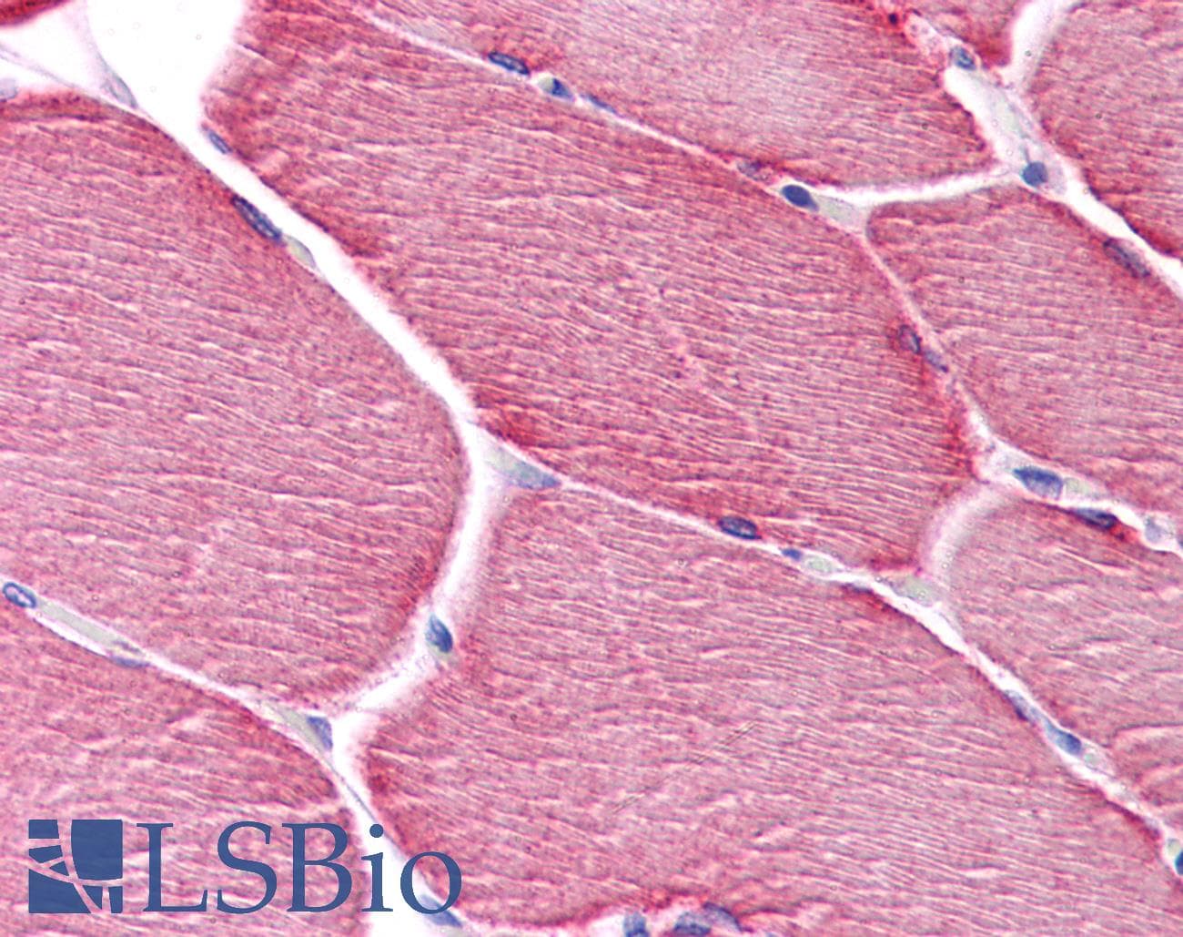 IHC-plus™ PPAPDC3 Antibody