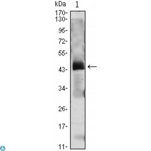 PTH / Parathyroid Hormone Antibody