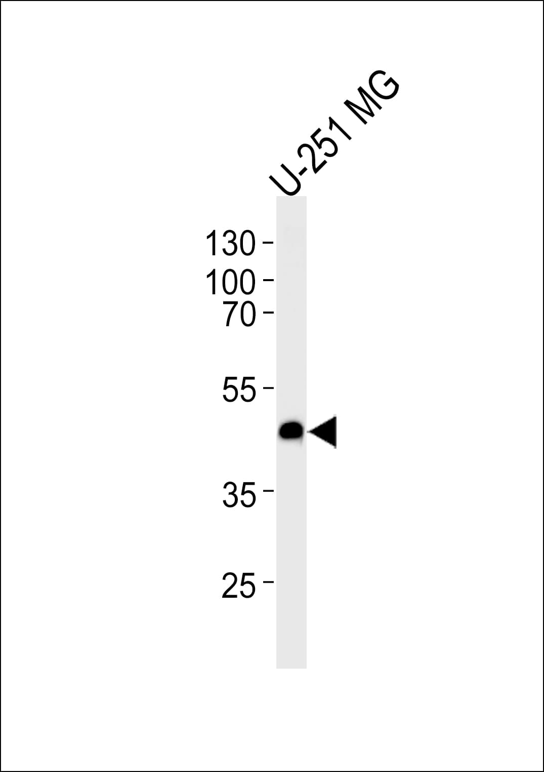 ACKR3 / CXCR7 Antibody (aa330-358)