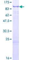 Human RPUSD2 Protein (Recombinant GST)