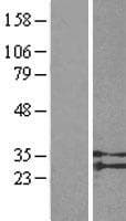 SUCNR1 / GPR91 Protein (Over-Expression Lysate Myc-DDK (Flag))