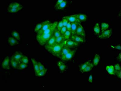 Polyclonal Rabbit anti-Human SERPINA6 / CBG Antibody (WB)