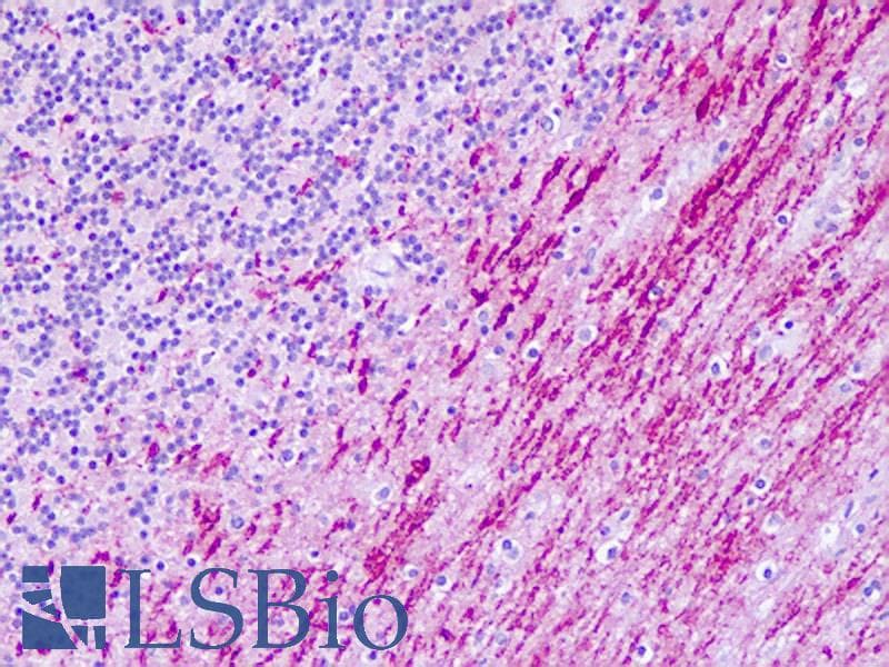 PathPlus™ HTR6 / 5-HT6 Receptor Antibody (C-Terminus)
