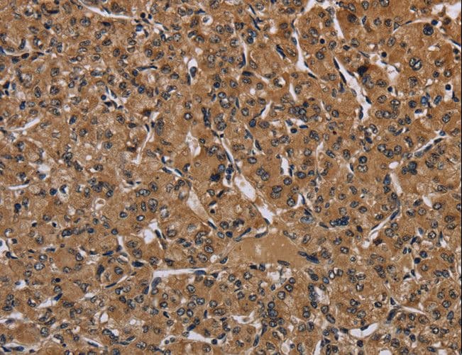 HIF1A / HIF1 Alpha Antibody