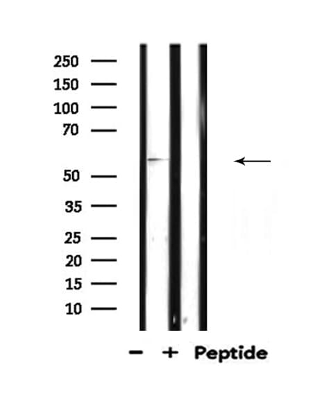 TCF4 Antibody