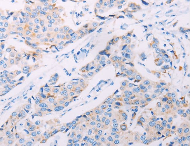 Polyclonal Rabbit anti-Human AKT2 Antibody (IHC)