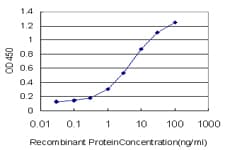 IHC-plus™ SMAD3 Antibody (clone 7F3)