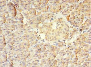 MS / MTR Antibody