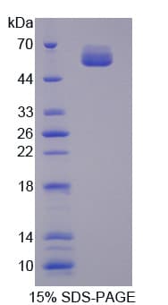 Human SDSL / Serine Dehydratase-Like Protein (Recombinant His-GST)