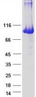 Human PYGL Protein (Recombinant Myc-DDK (Flag))