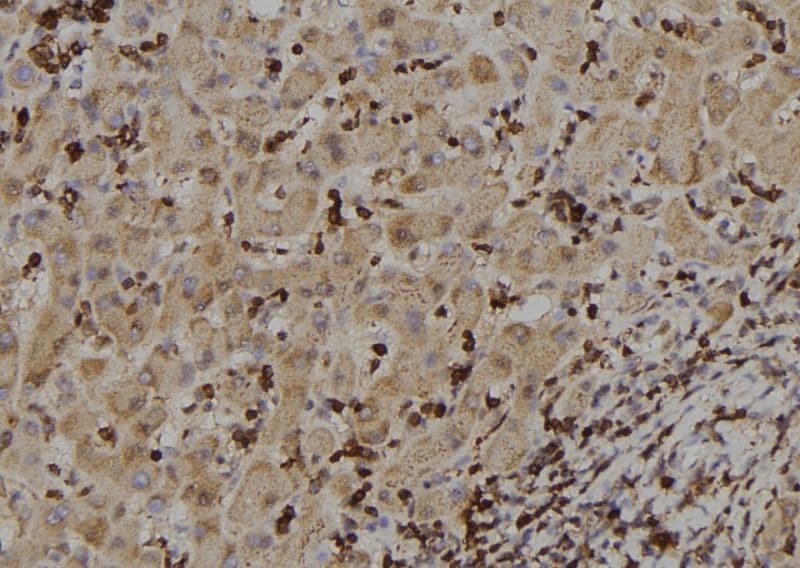 RIOK2 Antibody