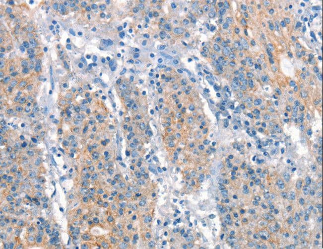 ARHGEF11 Antibody