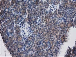 Monoclonal Mouse anti-Human DSTN / Destrin Antibody (clone OTI1B8, IHC, WB)