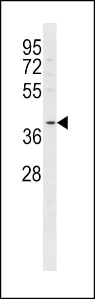 IHC-plus™ FFAR2 / GPR43 Antibody (aa286-315)