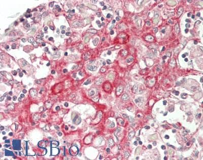 IHC-plus™ STX6 / Syntaxin 6 Antibody (aa75-125)