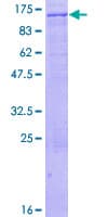 Human ZKSCAN5 Protein (Recombinant GST)