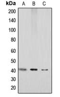 Polyclonal Rabbit anti-Human ACKR3 / CXCR7 Antibody (C-Terminus, IHC, WB)