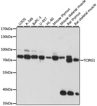 Polyclonal Rabbit anti-Human TIRC7 / TCIRG1 Antibody (WB)