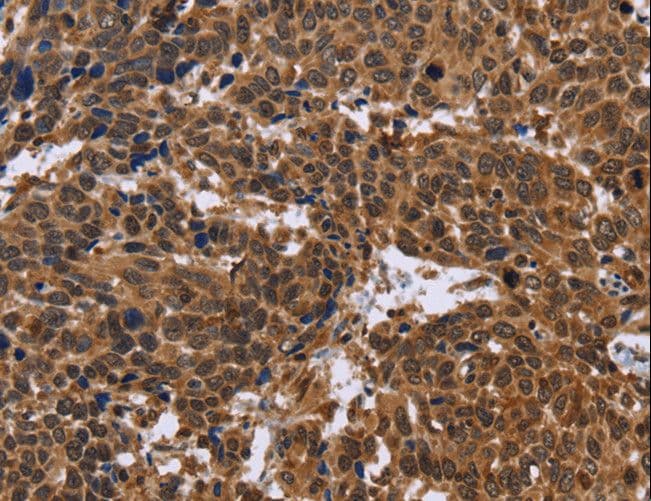 EDN2 / Endothelin 2 Antibody