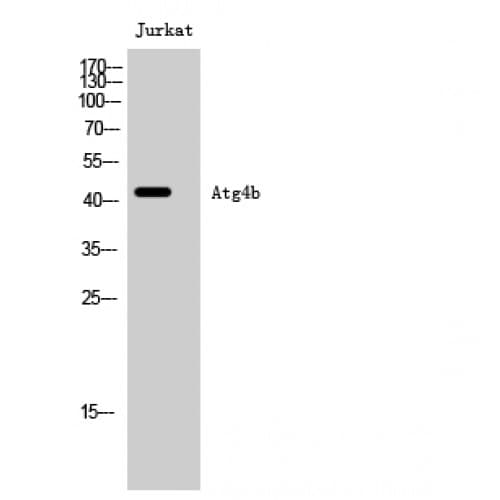 APG4B / ATG4B Antibody (40-120 aa, Internal)