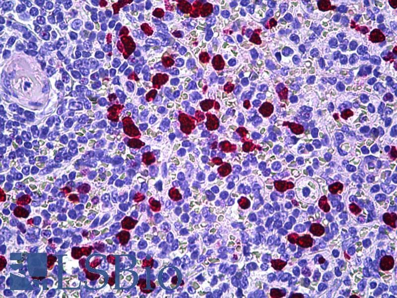 IHC-plus™ HRS / HGS Antibody (aa451-500)