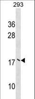 MMS2 / UBE2V2 Antibody (aa75-104)