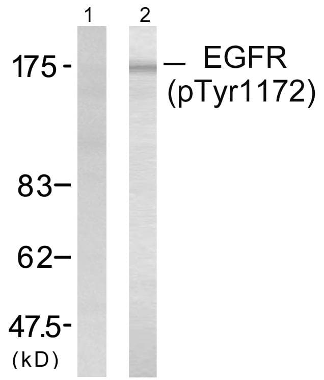 Polyclonal Rabbit anti-Human EGFR Antibody (phospho-Tyr1172, WB)