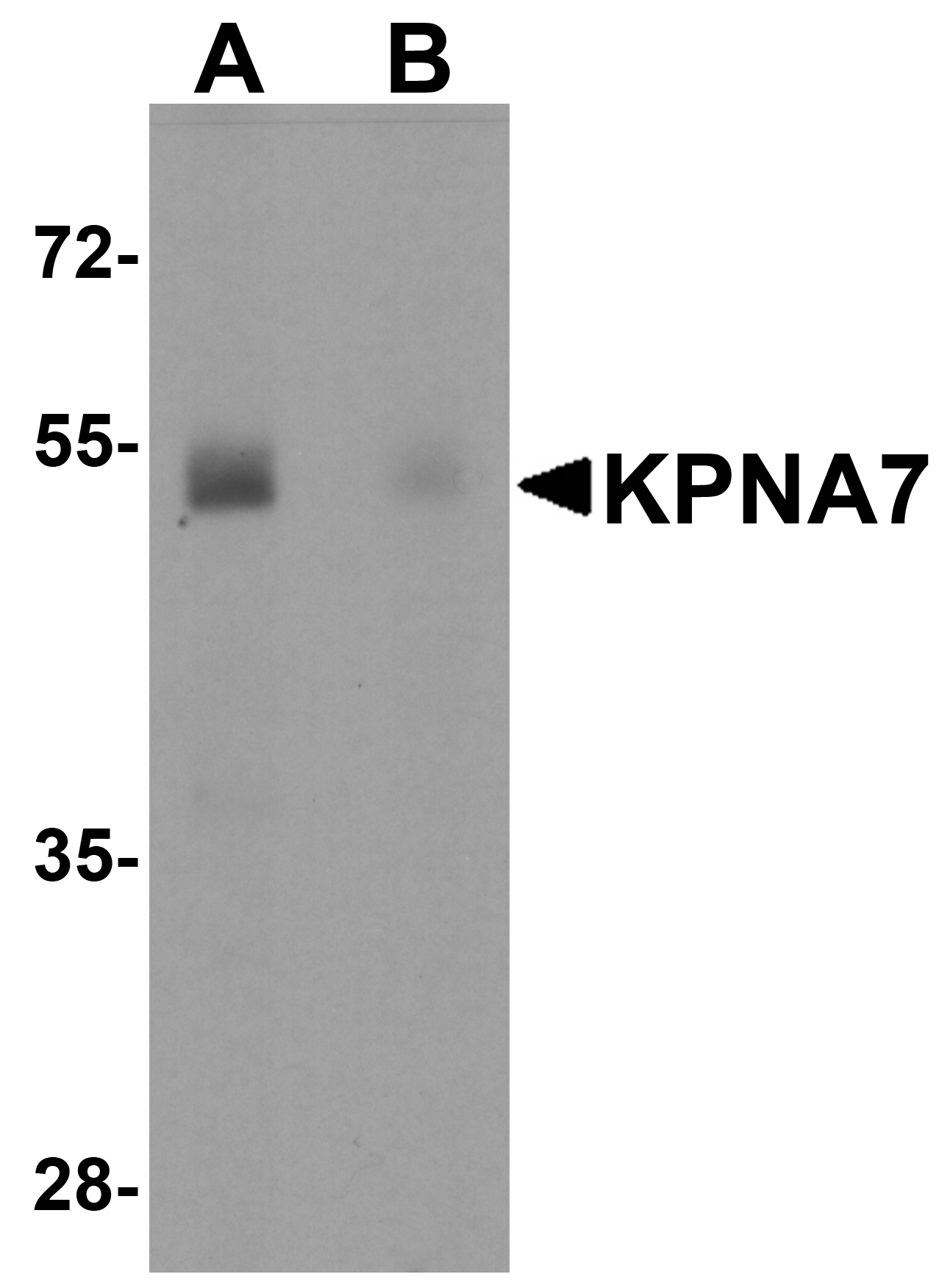 IHC-plus™ KPNA7 Antibody