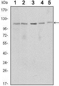 SIRT1 / Sirtuin 1 Antibody (clone 1F3)