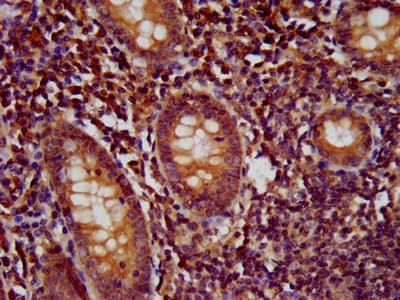WDR37 Antibody