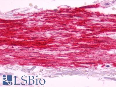 PathPlus™ Polyclonal Rabbit anti-Human B1R / BDKRB1 Antibody (Cytoplasmic Domain, IHC)