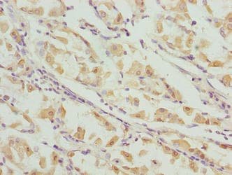 VWA9 / C15orf44 Antibody