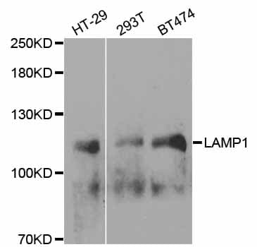 IHC-plus™ LAMP1 / CD107a Antibody