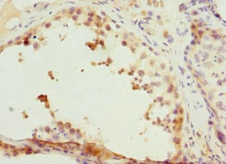 CCNE2 / Cyclin E2 Antibody