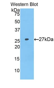 F9 / Factor IX Antibody (aa232-455)