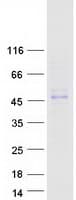 Human AIM / CD5L Protein (Recombinant Myc-DDK (Flag))