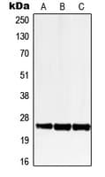 IHC-plus™ LRAT Antibody (Internal)