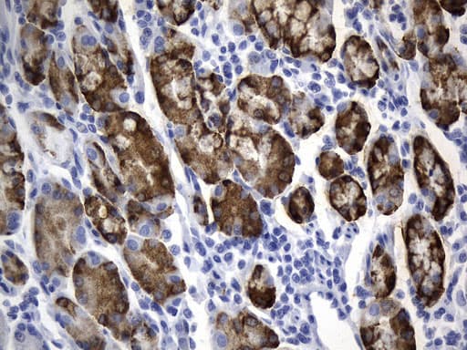 Monoclonal Mouse anti-Human AGR2 Antibody (clone UMAB245, aa21-175, IHC)
