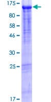 Human QRICH1 Protein (Recombinant GST)