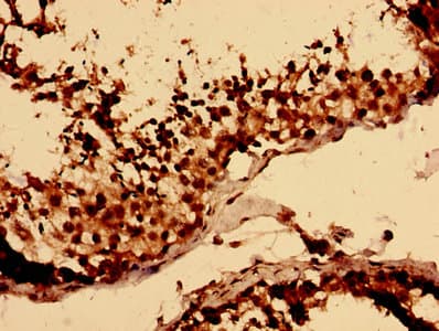 Polyclonal Rabbit anti-Human LY6H Antibody