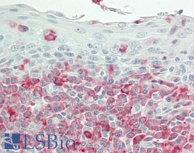 IHC-plus™ Polyclonal Rabbit anti-Human UBFD1 Antibody (C-Terminus, IHC, WB)